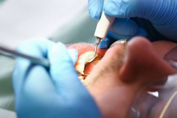 Best Emergency Treatment for Toothache in Beloit, KS